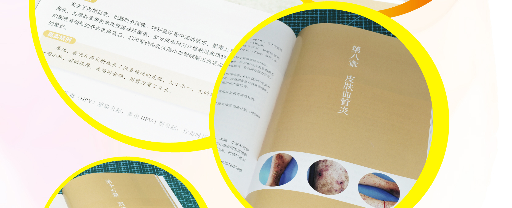 最新皮肤科大全书籍引领探索皮肤健康奥秘的世界